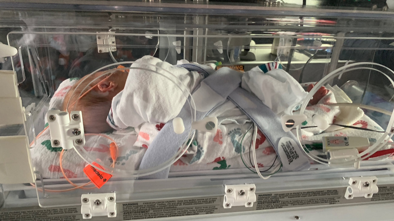 Walker Brinson as a newborn in the NICU incubator.